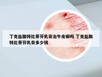 丁克盐酸特比萘芬乳膏治牛皮癣吗 丁克盐酸特比萘芬乳膏多少钱