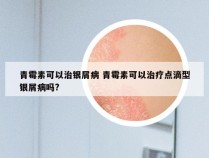 青霉素可以治银屑病 青霉素可以治疗点滴型银屑病吗?