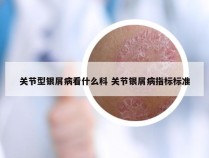 关节型银屑病看什么科 关节银屑病指标标准