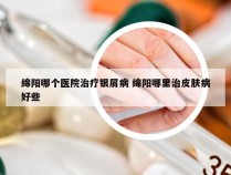 绵阳哪个医院治疗银屑病 绵阳哪里治皮肤病好些
