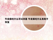 牛皮癣吃什么可以改善 牛皮癣吃什么有助于恢复