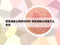 银屑病静止期用吃药吗 银屑病静止期是什么意思