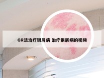 GR法治疗银屑病 治疗银屑病的视频