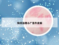 如何治理小广告牛皮癣
