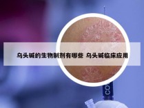 乌头碱的生物制剂有哪些 乌头碱临床应用