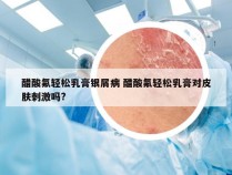 醋酸氟轻松乳膏银屑病 醋酸氟轻松乳膏对皮肤刺激吗?