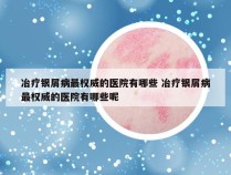 冶疗银屑病最权威的医院有哪些 冶疗银屑病最权威的医院有哪些呢