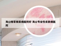 海口哪家银屑病医院好 海口专业性皮肤病医院