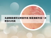 头部银屑病可以照紫外线 银屑病紫外线一次照多久时间