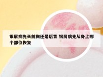 银屑病先长前胸还是后背 银屑病先从身上哪个部位恢复