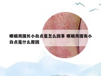 眼睛周围长小白点是怎么回事 眼睛周围有小白点是什么原因