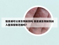 销屑病可以用生物制剂吗 银屑病生物制剂纳入医保报销范围吗?