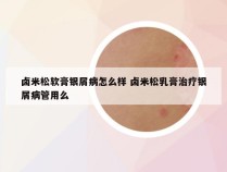 卤米松软膏银屑病怎么样 卤米松乳膏治疗银屑病管用么