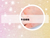 牛皮癣拖