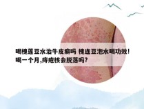 喝槐莲豆水治牛皮癣吗 槐连豆泡水喝功效!喝一个月,痔疮核会脱落吗?