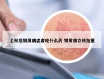 上秋后银屑病忠者吃什么药 银屑病立秋加重