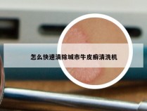 怎么快速清除城市牛皮癣清洗机