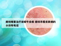 廊坊哪里治疗顽癣牛皮癣 廊坊市看皮肤病的小诊所电话