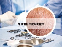 中国治疗牛皮癣的医生