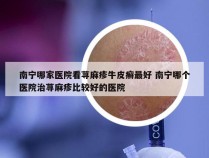 南宁哪家医院看荨麻疹牛皮癣最好 南宁哪个医院治荨麻疹比较好的医院