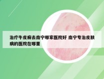 治疗牛皮癣去南宁哪家医院好 南宁专治皮肤病的医院在哪里