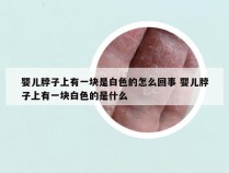 婴儿脖子上有一块是白色的怎么回事 婴儿脖子上有一块白色的是什么