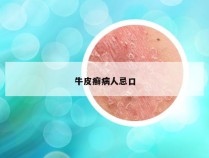 牛皮癣病人忌口