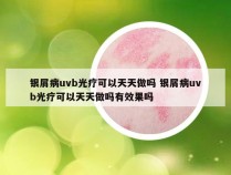 银屑病uvb光疗可以天天做吗 银屑病uvb光疗可以天天做吗有效果吗