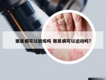 银屑病可以锻炼吗 银屑病可以运动吗?