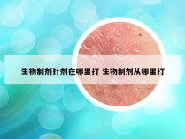 生物制剂针剂在哪里打 生物制剂从哪里打