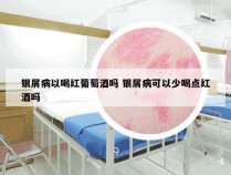 银屑病以喝红葡萄酒吗 银屑病可以少喝点红酒吗