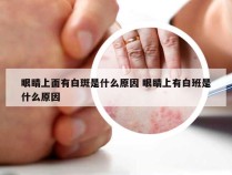 眼睛上面有白斑是什么原因 眼睛上有白班是什么原因