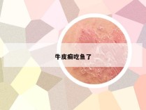 牛皮癣吃鱼了