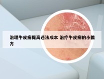 治理牛皮癣提高违法成本 治疗牛皮癣的小偏方
