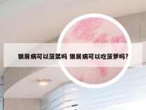 银屑病可以菠菜吗 银屑病可以吃菠萝吗?