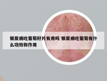 银屑病吃葡萄籽片有用吗 银屑病吃葡萄有什么功效和作用