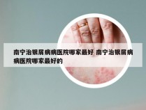 南宁治银屑病病医院哪家最好 南宁治银屑病病医院哪家最好的