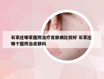 石家庄哪家医院治疗皮肤病比较好 石家庄 哪个医院治皮肤科