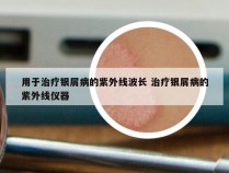 用于治疗银屑病的紫外线波长 治疗银屑病的紫外线仪器