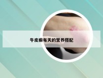 牛皮癣每天的营养搭配