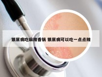 银屑病吃麻辣香锅 银屑病可以吃一点点辣