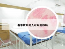 看牛皮癣的人可以刮痧吗