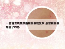一感冒发烧皮脓疱银屑病就复发 感冒银屑病加重了咋办