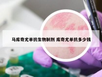 马库奇尤单抗生物制剂 库奇尤单抗多少钱