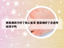 银屑病孩子好了担心复发 银屑病好了会遗传给孩子吗