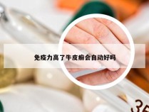 免疫力高了牛皮癣会自动好吗