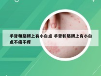 手背和胳膊上有小白点 手背和胳膊上有小白点不痛不痒