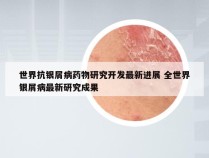 世界抗银屑病药物研究开发最新进展 全世界银屑病最新研究成果