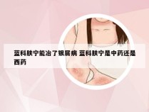 蓝科肤宁能冶了银屑病 蓝科肤宁是中药还是西药