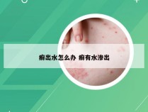 癣出水怎么办 癣有水渗出